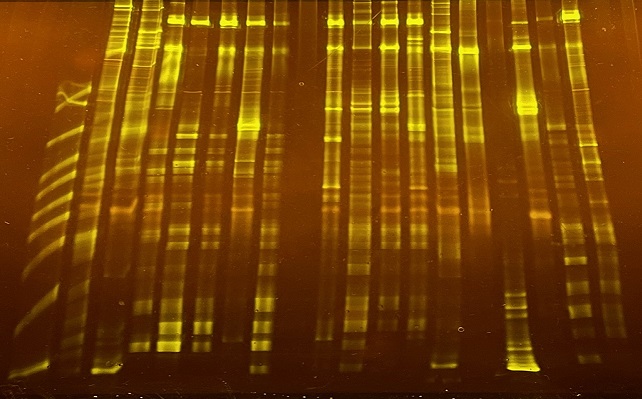PCR技術により増幅された土壌微生物の遺伝子。黄色に輝くバンドは微生物の遺伝子を示しており、自然界にはまだ培養にすら成功していない微生物が多数いることがわかります。